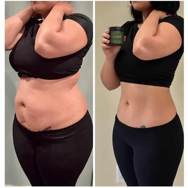 Antes y después de clienta con LUMÉ